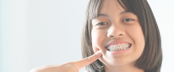 Aparelhos Ortodônticos